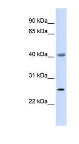 ADA / Adenosine Deaminase antibody western blot of Fetal Muscle lysate.