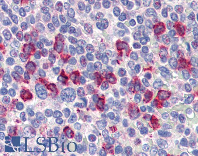 Anti-CD14 antibody IHC of human spleen. Immunohistochemistry of formalin-fixed, paraffin-embedded tissue after heat-induced antigen retrieval. Antibody LS-B3012 concentration 4 ug/ml.