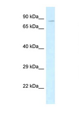 CDH5 / VE Cadherin antibody LS-C145451 Western blot of Fetal Heart lysate. Antibody concentration 1 ug/ml.