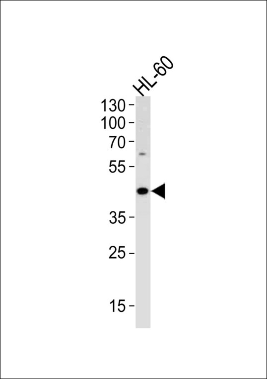 ADA Antibody western blot of HL-60 cell line lysates (35 ug/lane). The ADA antibody detected the ADA protein (arrow).