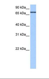 HEPG2 cell lysate. Antibody concentration: 0.5 ug/ml. Gel concentration: 12%.