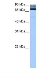 Liver cell lysate. Antibody concentration: 0.5 ug/ml. Gel concentration: 12%.