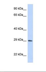 Western blot of Human Transfected 293T. ADAL antibody dilution 1.0 ug/ml.