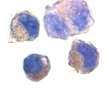 Immunocytochemical staining of K562 cells using ADAM10 antibody at 2 µg/ml.