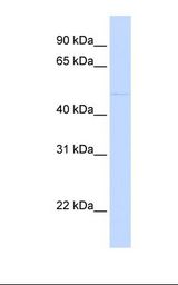 MCF7 cell lysate. Antibody concentration: 1.0 ug/ml. Gel concentration: 12%.
