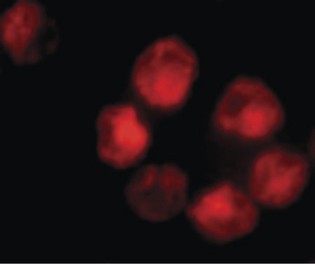 Immunofluorescence of ADAM10 in K562 cells with ADAM10 antibody at 10 ug/ml.