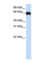 ADAM12 antibody LS-C110628 Western blot of Placenta lysate.