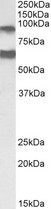 ADAM12 antibody (0.3 ug/ml) staining of Mouse Heart lysate (35 ug protein in RIPA buffer). Primary incubation was 1 hour. Detected by chemiluminescence.