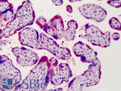 Anti-ADAM12 antibody IHC of human placenta. Immunohistochemistry of formalin-fixed, paraffin-embedded tissue after heat-induced antigen retrieval. Antibody LS-B2756 concentration 3.75 ug/ml.