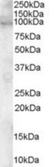 Antibody staining (0.1 ug/ml) of human heart lysate (RIPA buffer, 30 ug total protein per lane). Primary incubated for 1 hour. Detected by Western blot of chemiluminescence.