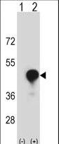 Western blot of CD1C (arrow) using rabbit polyclonal CD1C Antibody. 293 cell lysates (2 ug/lane) either nontransfected (Lane 1) or transiently transfected (Lane 2) with the CD1C gene.