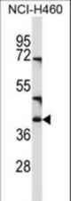 CD1C Antibody western blot of NCI-H460 cell line lysates (35 ug/lane). The CD1C antibody detected the CD1C protein (arrow).