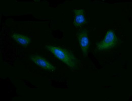 Immunofluorescent staining of HeLa cells using anti-CD1C mouse monoclonal antibody.