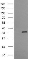 HEK293T cells were transfected with the pCMV6-ENTRY control (Left lane) or pCMV6-ENTRY CD1C (Right lane) cDNA for 48 hrs and lysed. Equivalent amounts of cell lysates (5 ug per lane) were separated by SDS-PAGE and immunoblotted with anti-CD1C.