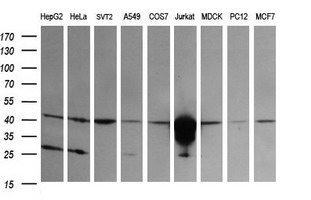 Western blot of extracts (35 ug) from 9 different cell lines by using anti-CD1C monoclonal antibody (HepG2: human; HeLa: human; SVT2: mouse; A549: human; COS7: monkey; Jurkat: human; MDCK: canine; PC12: rat; MCF7: human).