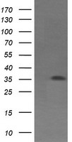 HEK293T cells were transfected with the pCMV6-ENTRY control (Left lane) or pCMV6-ENTRY CD1C (Right lane) cDNA for 48 hrs and lysed. Equivalent amounts of cell lysates (5 ug per lane) were separated by SDS-PAGE and immunoblotted with anti-CD1C.