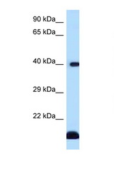 CD1D antibody LS-C146068 Western blot of Fetal Heart lysate. Antibody concentration 1 ug/ml.