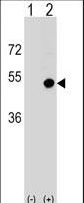Western blot of CD1D (arrow) using rabbit polyclonal CD1D Antibody. 293 cell lysates (2 ug/lane) either nontransfected (Lane 1) or transiently transfected (Lane 2) with the CD1D gene.
