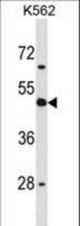 CD1D Antibody western blot of K562 cell line lysates (35 ug/lane). The CD1D antibody detected the CD1D protein (arrow).
