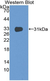 Western blot of recombinant CD1E.