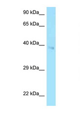 CD2 antibody LS-C146537 Western blot of HCT15 Cell lysate. Antibody concentration 1 ug/ml.