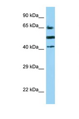 CD2 antibody LS-C146235 Western blot of COL0205 Cell lysate. Antibody concentration 1 ug/ml.