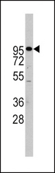 Western blot of ADAM17 Antibody in Jurkat cell line lysates (35 ug/lane). ADAM17(arrow) was detected using the purified antibody.