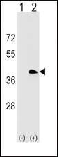 Western blot of MS4A1 (arrow) using rabbit polyclonal MS4A1 Antibody. 293 cell lysates (2 ug/lane) either nontransfected (Lane 1) or transiently transfected (Lane 2) with the MS4A1 gene.