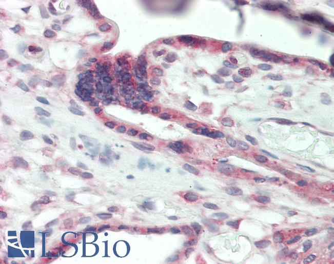 Human Placenta: Formalin-Fixed, Paraffin-Embedded (FFPE)