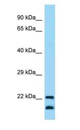 CD200 antibody Western Blot of Human fetal lung lysate. Antibody dilution: 1 ug/ml.