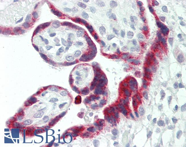 Human Placenta: Formalin-Fixed, Paraffin-Embedded (FFPE)