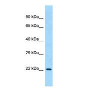Western blot of Human HeLa whole cell lysate. CD200 antibody dilution 1.0 ug/ml.