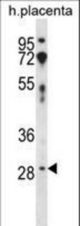 CD200 Antibody western blot of human placenta tissue lysates (35 ug/lane). The CD200 antibody detected the CD200 protein (arrow).