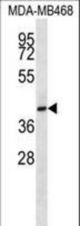 CD200R1 Antibody western blot of MDA-MB468 cell line lysates (35 ug/lane). The CD200R1 antibody detected the CD200R1 protein (arrow).