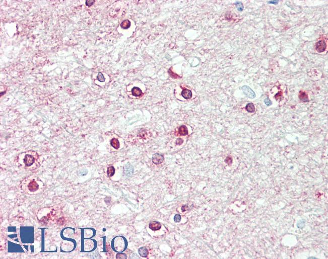 Anti-CD200R1 / CD200R antibody IHC staining of human brain, cortex, white matter. Immunohistochemistry of formalin-fixed, paraffin-embedded tissue after heat-induced antigen retrieval.