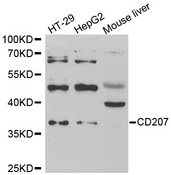 Western blot analysis of extracts of various cell lines, using CD207 antibody.