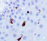 IHC of Langerin on FFPE Skin tissue.