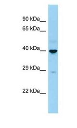 CD207 / LANGERIN antibody Western Blot of Fetal Kidney . Antibody dilution: 1 ug/ml.