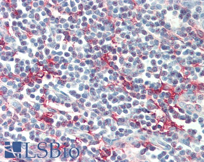 Anti-CD209 / DC-SIGN antibody IHC of human tonsil. Immunohistochemistry of formalin-fixed, paraffin-embedded tissue after heat-induced antigen retrieval. Antibody LS-B479 concentration 5 ug/ml.