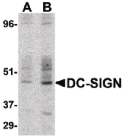 Western blot detection of DC-SIGN in human small intestine at (A) 1 and (B) 2 ug /ml.