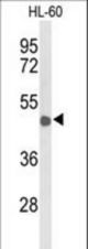 Western blot of CD209 Antibody in HL-60 cell line lysates (35 ug/lane). CD209 (arrow) was detected using the purified antibody.