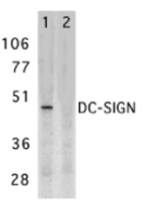 Western blot of DC-SIGN expression in human placenta tissue lysate in the absence (lane 1) and presence (lane 2) of blocking peptide with DC-SIGN antibody at 2 ug /ml.