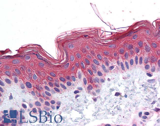 Anti-ADAM17 antibody IHC of human skin. Immunohistochemistry of formalin-fixed, paraffin-embedded tissue after heat-induced antigen retrieval. Antibody LS-B4437 concentration 3.75 ug/ml.
