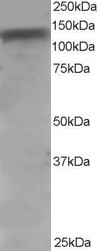 HeLa lysate (RIPA buffer, 35 ug total protein per lane). Primary incubated for 1 hour. Detected by Western blot of chemiluminescence.