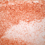 Frozen human tonsil section stained with UltraVision LP and AEC chromogen. Note membrane staining of lymphocytes.