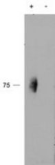 CD244 antibody (2 ug/ml) staining of IP from a lysate of Human Natural Killer cells with (+) or without (-) pervanadate treatment of the cells. Primary incubation was 1 hour. Detected by chemiluminescence.