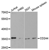 Western blot analysis of extracts of various cell lines, using CD244 antibody.