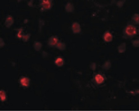Immunofluorescence of SLAMF4 in Daudi cells with SLAMF4 antibody at 20 ug/ml.