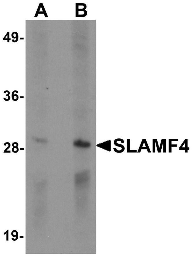 Western blot analysis of SLAMF4 in Daudi cell lysate with SLAMF4 antibody at (A) 1 and (B) 2 ug/ml.