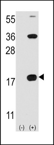Western blot of CD3Z (arrow) using rabbit polyclonal CD3Z Antibody. 293 cell lysates (2 ug/lane) either nontransfected (Lane 1) or transiently transfected with the CD3Z gene (Lane 2) (Origene Technologies).